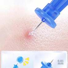 50 chiếc kim mụn dùng một lần, dụng cụ lấy mụn đầu đen kín, dụng cụ lấy mụn, dụng cụ xóa vết thâm - Nhiều màu - Xem 3