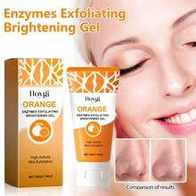 OUHOE 50g Exfoliating Gel, Pore Minimizing Scrub For Face & Body - Gently Removes Blackheads & Dead Skin, Unclogs Pores For Smooth, Glowing Skin - Daily Use For All Skin Types,Skin Care Sets,Makeup,Skin Care,Travel Essential,Quick Ship Items,Free Shipping - 橙子味去角質凝膠 - 查看 3