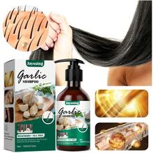 Champú de ajo, champú anticaspa para el cabello con picazón, elimina la caspa, hongos, previene la picazón del cuero cabelludo, la psoriasis y la caída del cabello - 1 - Ver 5