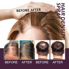 Spray para espesar el cabello - Tratamiento voluminizador para cabello fino y delgado, fórmula nutritiva con textura ligera, no grasa - 1 - Ver 3