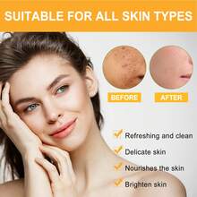 OUHOE 50g Exfoliating Gel, Pore Minimizing Scrub For Face & Body - Gently Removes Blackheads & Dead Skin, Unclogs Pores For Smooth, Glowing Skin - Daily Use For All Skin Types,Skin Care Sets,Makeup,Skin Care,Travel Essential,Quick Ship Items,Free Shipping - 深層去角質凝膠 - 查看 5