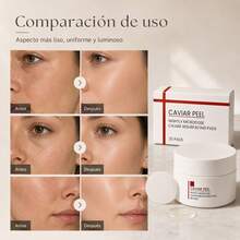 Exfoliating Facial Peels - Caviar - View 6