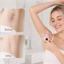 Body Hair Trimmer Bikini Hair Trimmer, Leg Hair Remover, Lcd Power Display Rechargeable Mini Hair Trimmer - Silver - View 5
