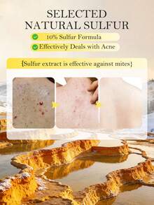 SADOER 硫磺防蟎手工皂，提亮膚色皂，深層清潔控油沐浴皂，適用於臉部、手部、身體、背部，深層清潔去污去角質，保持乾爽的手工皂，身體護理皂 - Coconut - 查看 3