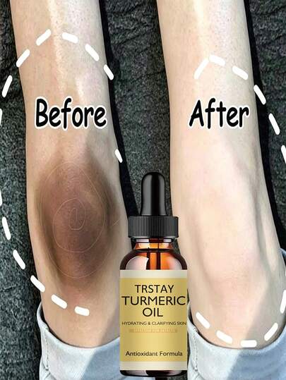 5ML/15ML/30ML/50ML/100ML/New Turmeric Oil Glow To Facial Lightening Serum For Black Brown Skin Leg Hand Body Bright White For Dark Skin Beauty Health