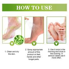 Spray desodorante para pies de 30 ml, elimina el olor de los zapatos y los pies sudorosos, desodorante natural para zapatos y pies. - 1 - Ver 11