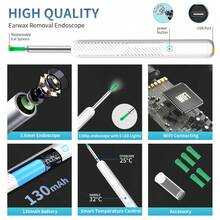 NATFIRE 1 Set Portable Illuminated Earwax Removal Endoscope Ear Cleaning Kit With Micro Camera, Includes 8 Ear Scoops, Otoscope, Type-C Charging, Wireless Smart Visual Self-Care Endoscope, Compatible With IPhone And Android Phones, Gift For Family And Friends - Multicolor - View 6
