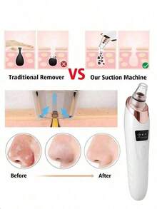 AXH Electric Blackhead Remover Pore Vacuum Cleaner Acne Cleaning Device - White - View 5