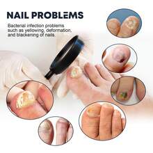 Spray de uñas Fortalecedor de uñas y tratamiento de crecimiento para uñas frágiles Reparación de uñas Cuidado de la cutícula Limpiador de superficie de uñas - 1 - Ver 4