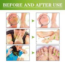 Spray desodorante para pies de 30 ml, elimina el olor de los zapatos y los pies sudorosos, desodorante natural para zapatos y pies. - 1 - Ver 4