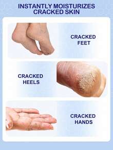 60% Urea Hydrating And Anti-Cracking Foot Cream, 2025 Upgraded Moisturising And Relieves Cracking And Dryness Foot Cream, Foot Lotion Heel Stick And Hydrates Dry And Cracked Feet And Hand - 1 - View 3
