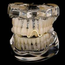 Grillz - Parrillas para tus dientes, tapa de dientes dorados, 2 piezas chapadas en oro de 14 quilates con diamante Möbius de un solo diente para hombres y mujeres - Plata1 - Ver 2