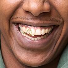 Grillz - Parrillas para tus dientes, tapa de dientes dorados, 2 piezas chapadas en oro de 14 quilates con diamante Möbius de un solo diente para hombres y mujeres - Plata1 - Ver 6