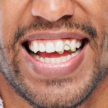 Grillz - Parrillas para tus dientes, tapa de dientes dorados, 2 piezas chapadas en oro de 14 quilates con diamante Möbius de un solo diente para hombres y mujeres - Plata1 - Ver 5