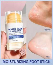 60% Urea Hydrating And Anti-Cracking Foot Cream, 2025 Upgraded Moisturising And Relieves Cracking And Dryness Foot Cream, Foot Lotion Heel Stick And Hydrates Dry And Cracked Feet And Hand - 1 - View 5