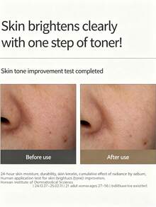 I'm From Rice Toner, Watery Texture, Brightening Hydrating, Fermented Formula, Smooths Skin, No Alcohol, All Skin Types, Long-Lasting, Moisturizing, Nourishing, K-Beauty, Korean Makeup, GIFT, 150ml/5.07fl.Oz - 150ml - View 4