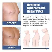 Men's Firming Patch: Men's Chest Skin Firming And Anti-Sagging Chest Muscle Care Patch - 1 - View 3