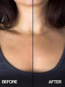 Silikon - Brust und Hals, für die Nachtnutzung - wiederverwendbar, glättet und verjüngt die Haut - reduziert Anzeichen von Alterung für Frauen und Mädchen, Hautpflege, Hautpflegewerkzeuge, Lifting, Faltenentfernung - Verschiedenfarbig - Übersicht 4