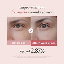 Medicube Eye Serum With Salmon DNA PDRN & Pink Peptides | For Fine Lines | PDRN & Niacinamide For Uneven Skin Tone - Retinol - View 4