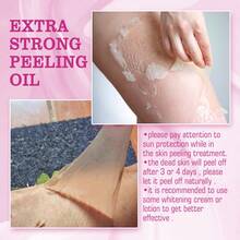 30ml Extra Strong Peeling Oil ,Skin Whitening, Dark Spots Remover, Skin Repair Contains Salicylic Acid And Sodium Hyaluronate To Effectively Smooth The Skin. The Special Even-Toning Solution Is Suitable For All Skin Types. - Tea Flavor - View 9