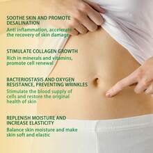 Stretch Mark Creams & Oils - 1 - View 9