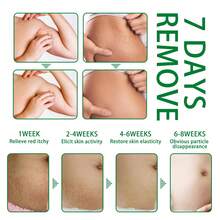 Stretch Mark Creams & Oils - 1 - View 3