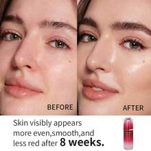 Shiseido Ultimune Power Infusing Concentrate Boosts Radiance & Improves Visible Signs Of Aging - All Skin Types - Non-Comedogenic  (ImuGenerationRED Technology) 75ml/2.5oz - 白色 - 查看 2