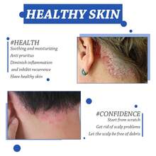 Scalp Treatment - 1 - View 6