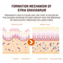 Stretch Mark Creams & Oils - 1 - View 5
