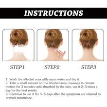 Scalp Treatment - 1 - View 8