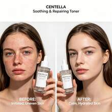 Centella Asiatica Repairing Serum, Deep Nourishing & Soothing Redness, Repairing Skin Barrier & Strengthening Skin Base, Suitable For Home, After-Sun, Soothing Multiple Scenarios, Unisex - Other - View 3