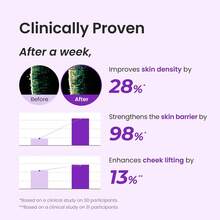 CNP Laboratory CNP PDRN Active Boost Face Serum 30ml, Salmon S-PDRN Infused Regenerating Facial Ampoule Boosts Collagen Production, Firm Fine Lines & Reduce Redness, Strengthen Damaged Skin Barrier, Deep Hydrating Anti-Aging Booster For Sensitive - 30毫升 - 查看 3