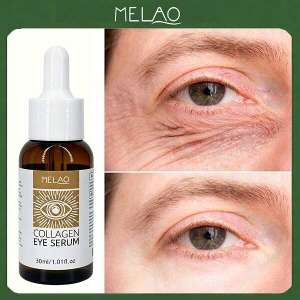  MELAO Collagen Eye Serum, Moisturizing Eye Serum Can Improve Dark Circles, Puffiness And Fine Lines, Daily Eye Care Serum, 30ml