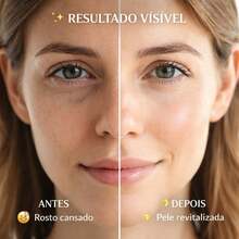 Kit Spa em Casa para Skincare – Rolo de Jade, Pedra Gua Sha e Crioterapia Facial - Kit Rolo Pedra+Foma de Gelo - Visão 6