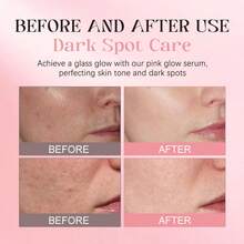 Medicub PDRN Pink Peptide Serum With Salmon DNA | Pink Glow Serum With Peptides & Niacinamide For Hydration & Firm-Looking Skin | Uneven Tone Care | Korean Skincare, 1.01 Fl. Oz - 鮭魚DNA PDRN - 查看 4