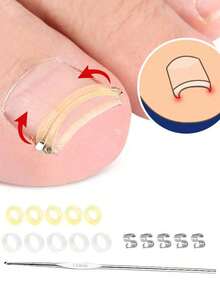 1pc Ingrown Toenail Correction Tool Set, Physical Reverse Stretching Painless Improvement For Ingrown Nails, Relieves Paronychia Pain, Suitable For Men And Women Daily Foot Care, Elegant Gift - Multicolor - View 1