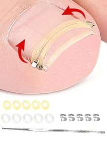 1pc Ingrown Toenail Correction Tool Set, Physical Reverse Stretching Painless Improvement For Ingrown Nails, Relieves Paronychia Pain, Suitable For Men And Women Daily Foot Care, Elegant Gift - Multicolor - View 6