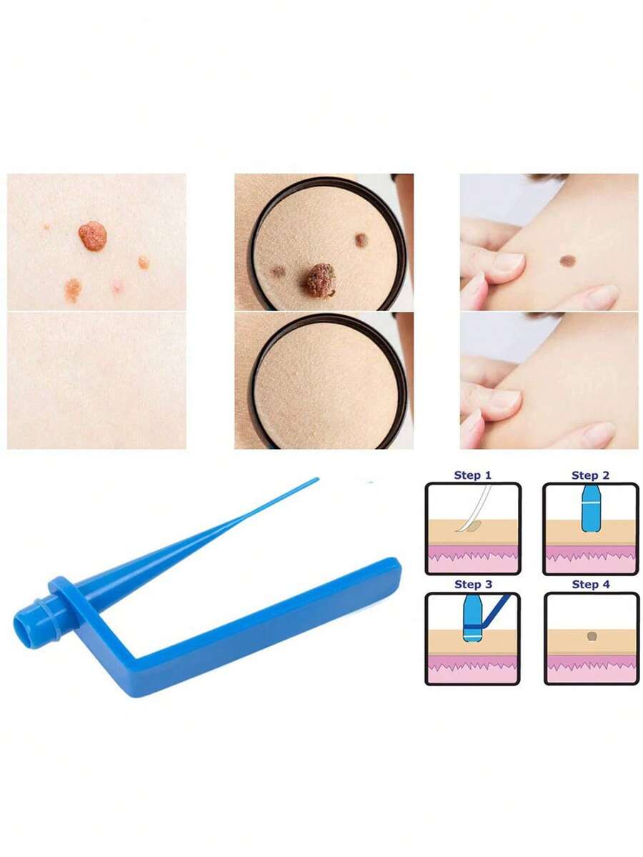 21/42pcs Exquisite Minimalist Convenient Facial Acne & Skin Tag Removal Tool, Suitable For Men And Women, Beautiful Holiday Gift - Multicolor - View 1