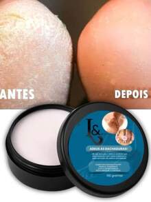 Creme L&Beauty para Rachaduras nos Pés - Hidratação e Tratamento 150g - Creme para rachaduras - Visão 4