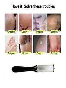 Foot Heel File, Callus Remover, Can Be Used With Foot Scrub, Professional Foot Brush And Callus Remover - Suitable For Removing Dead Skin, Especially For Cracked Heel Problems. Suitable For Home Foot Care/Warm Gift Choice, Covering Foot Care Tools, Foot Massagers, Foot Bath Accessories And Other Products, Suitable For Family, Personal Care Scenarios, Affordable Price, Great Choice For Holiday Gifts (Color And Style Sent Randomly) - A-Black - View 3