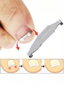 17pcs Professional Foot Care Tools, Ingrown Toenail Corrector, Anti-Friction Pads, Toenail Trimming And Recovery Embedded Toenail Patches - Multicolor - View 2