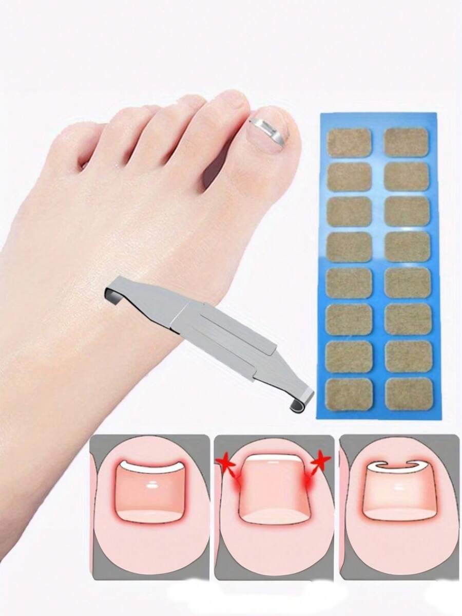 17pcs Professional Foot Care Tools, Ingrown Toenail Corrector, Anti-Friction Pads, Toenail Trimming And Recovery Embedded Toenail Patches - Multicolor - View 1
