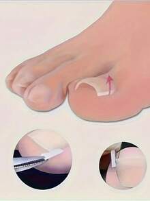 100pcs/Set Ingrown Toenail Correction Pads, Painless Ingrown For All Types Of Foot Care - Multicolor - View 4