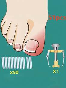 51-Piece Embedded Toe Nail Trimming Tool Kit, Includes Assistive Device And Separator, Soft-Touch Ingrown Nail Adjustment Tool Designed For Gentle Trimming, Softening And Care, Equipped With Odorless Nail File To Maintain Foot Hygiene - Multicolor - View 4