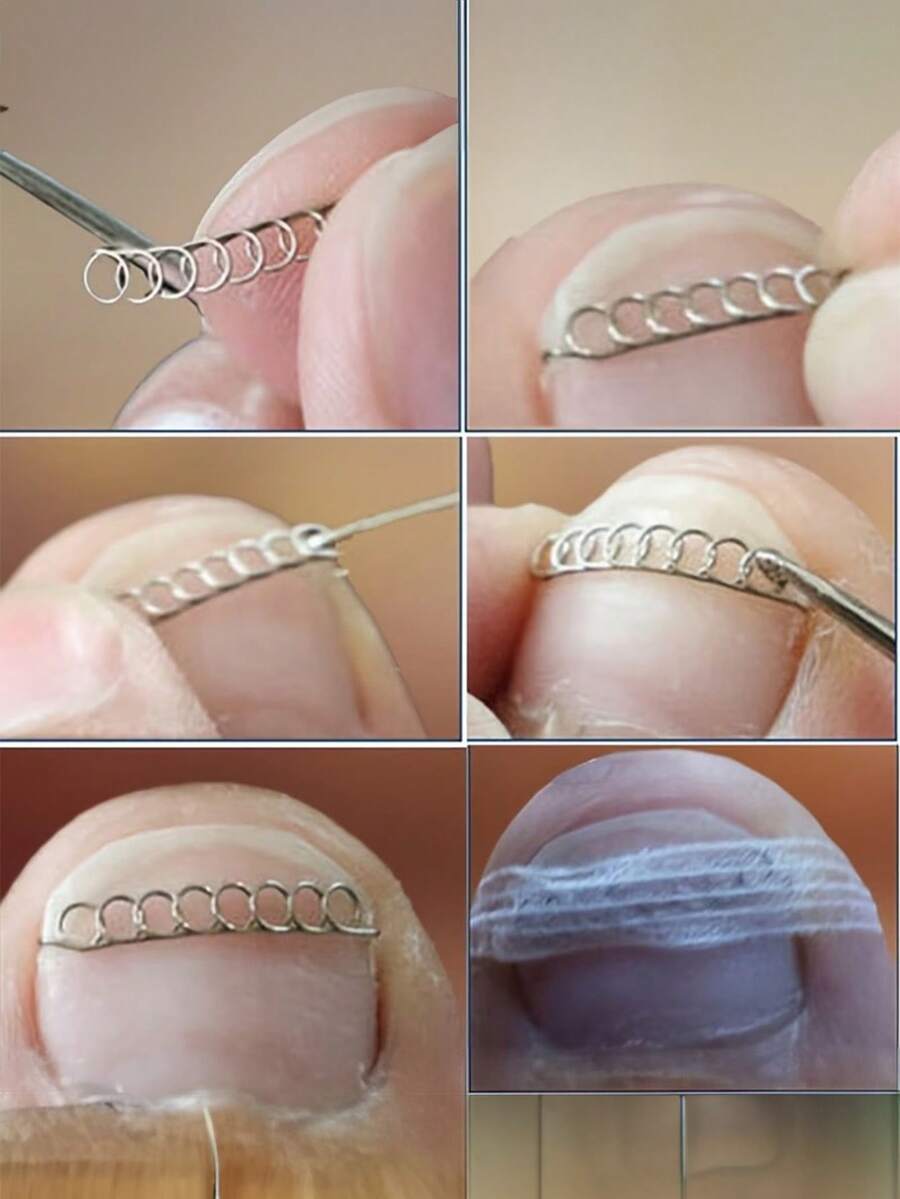 13/26/39pcs Nail Correction Wire With Hook, Multi-Size Nail Correction Wire Set, Durable And Long-Lasting, Ingrown Nail Traction Correction, Super Elastic Traction Resistant To Breaking, Simple Operation, Convenient For Home Use - Multicolor - View 1