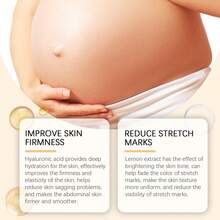 JAYSUING Postpartum & Pregnancy Stretch Mark & Firming Body Cream – Gentle Hydrating Belly Tightening Moisturizer For Smooth Skin, Daily Repair For Stretch Marks & Loose Skin - Collagen - View 2