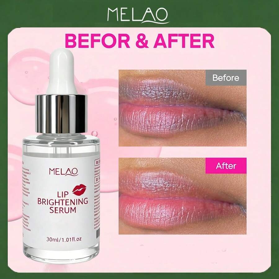 Serum Bibir MELAO, Essence Bibir yang Melembapkan dan Menghidrasi, Penggunaan Sehari-hari untuk Bibir yang Lembut, Halus, Montok, dan Sehat, Mengurangi Kekeringan, 30ml - 30 ml - View 1