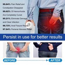 Natural Hemorrhoid Capsules,Hemorrhoid Treatment Rapid,Natural Herbal Strength HemorrhoidCapsules,He-Morrhoid Relief Capsules,HemorrhoidTreatment Rapid,External Hemorrhoids Treatment - 1 - 查看 5