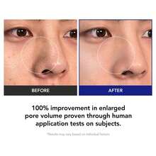 Toner Pads Zero Pore Pad 2.0 | 雙面紋理臉部化妝棉，含 4.5% AHA 乳酸與 0.45% BHA 水楊酸，適用於去角質與毛孔護理 | 適合所有膚質 70 片裝 (1 包) - 爽膚水 - 查看 5