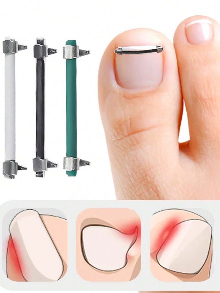 1pc Exquisite High-End Stainless Steel Painless Ingrown Toenail Correction Tool, Paronychia Pain Relief, Suitable For Men And Women Daily Foot Care, Beautiful Gift - Multicolor - View 1